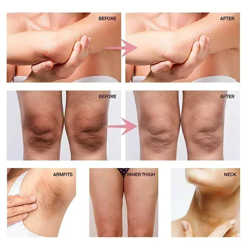 Collagen underarm whitening cr - Anti-Aging Face Cream บทวิจารณ์และราคา