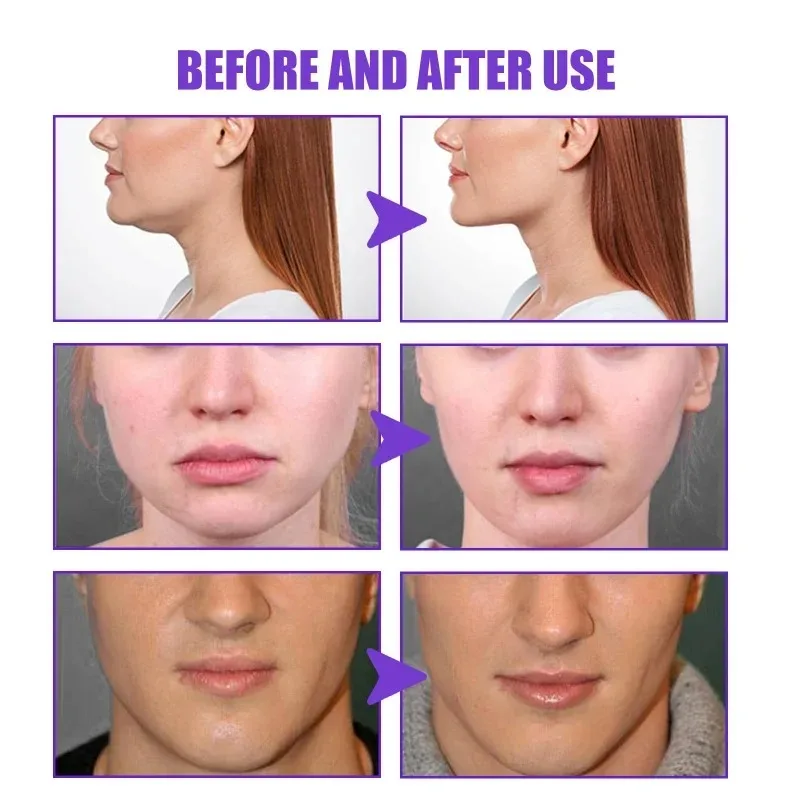 Face-lift Slimming Cream Slimm - Anti-Aging Face Cream บทวิจารณ์และราคา