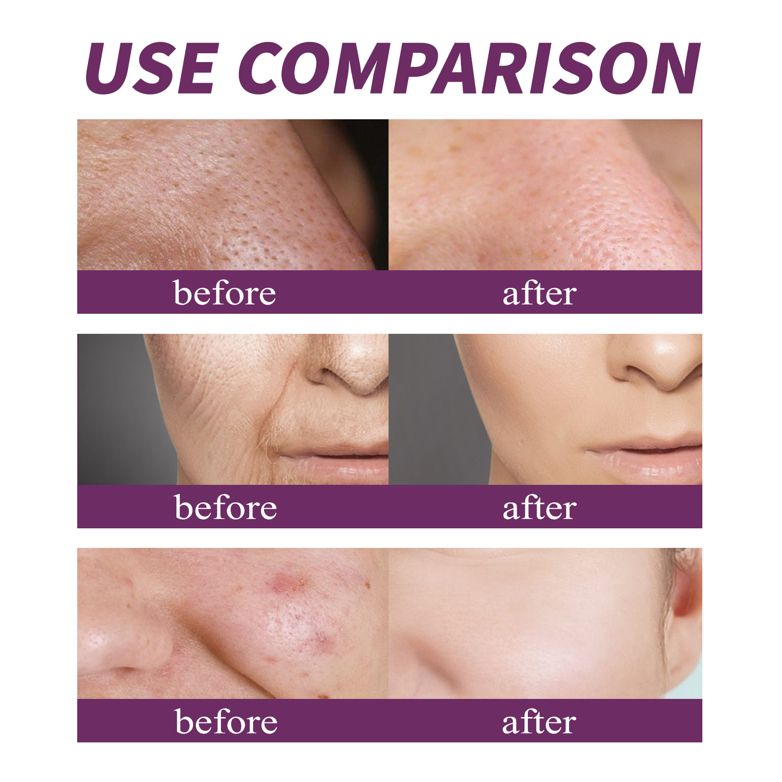 20% Niacinamide B3 Concentrate - Anti-Aging Face Cream บทวิจารณ์และราคา